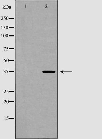 HNRNPA2B1 Antibody