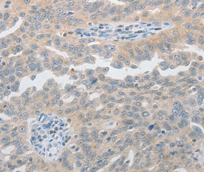 Polyclonal Rabbit anti-Human PIWIL2 Antibody (IHC, WB)