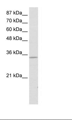 SNAI2 / SLUG Antibody (aa92-141)