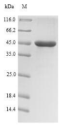 Pseudomonas aeruginosa rhlR Protein (Recombinant 10His-SUMO, N-terminus + Myc, C-terminus)