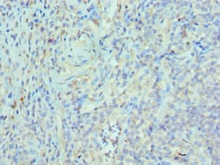 ETV6 / TEL Antibody (aa1-300)