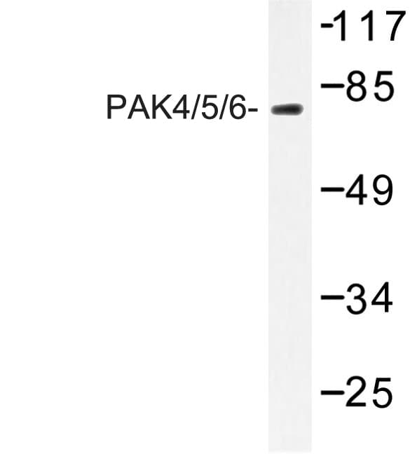 PAK4 + PAK5 + PAK6 Antibody (Val469)