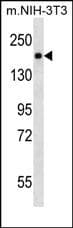 PDGFRB / PDGFR Beta Antibody (clone 275CT1)