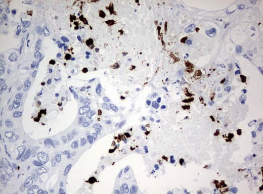 Monoclonal Mouse anti-Human PBX1 Antibody (clone UMAB111, IHC, IF)