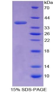 Mouse TNP1 / TP1 Protein (Recombinant His-GST)