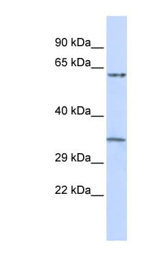 TRIM8 / GERP Antibody (aa360-409)