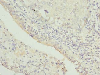 Polyclonal Rabbit anti-Human TMEM1 / TRAPPC10 Antibody (IHC)