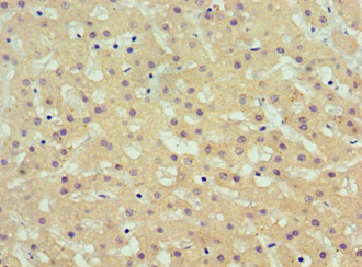 AKR1C4 / Chlordecone Reductase Antibody (aa1-323)