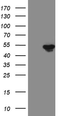 FOXP3 Antibody (clone OTI8G3, Carrier-free)