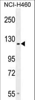 ADGRD2 / GPR144 Antibody (aa342-370)
