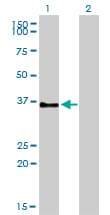 PathPlus™ GPR3 Antibody (clone 3B4-G3)