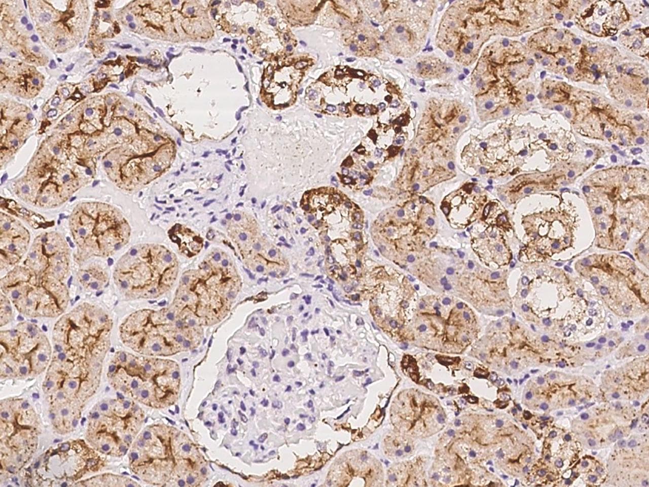 SRR / Serine Racemase Antibody