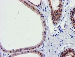 FBXO21 Antibody (clone OTI5H4)