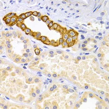 DRD4 / Dopamine Receptor D4 Antibody