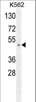 GTPBP2 Antibody (aa536-564)