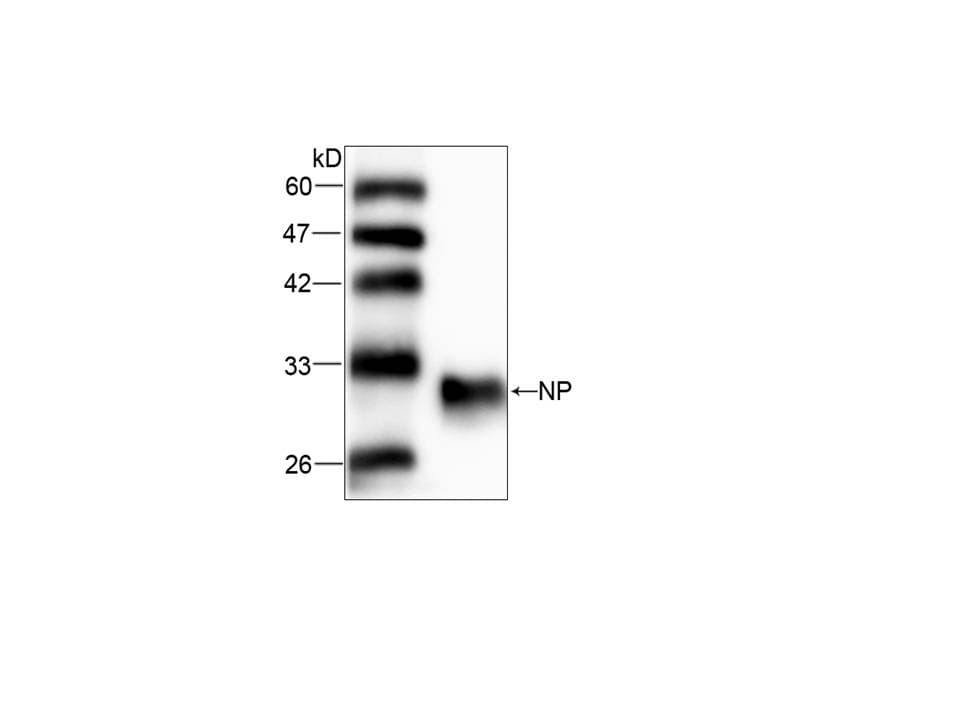 PNP / Nucleoside Phosphorylase Antibody (aa68-289)
