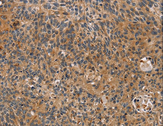 IHC-plus™ TAC1 Antibody