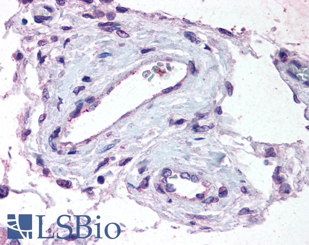 IHC-plus™ Polyclonal Rabbit anti-Human ADAMTS1 Antibody (Internal, IHC)