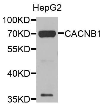 Polyclonal Rabbit anti-Human CACNB1 Antibody (IHC, WB)