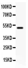 Polyclonal Rabbit anti-Rat CD80 Antibody (aa227-245, WB)