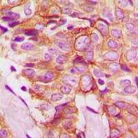 FZD8 / Frizzled 8 Antibody (C-Terminus)
