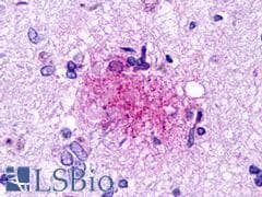 PathPlus™ GPR84 Antibody (Transmembrane Domain)