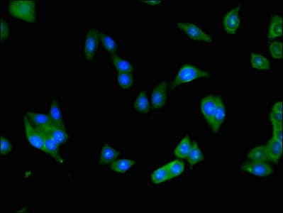 Polyclonal Rabbit anti-Human BAAT / BAT Antibody (IHC, IF)