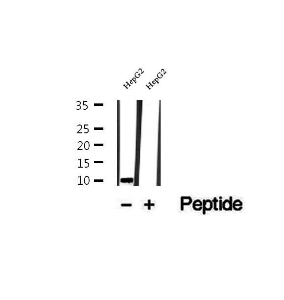 UQCRQ Antibody