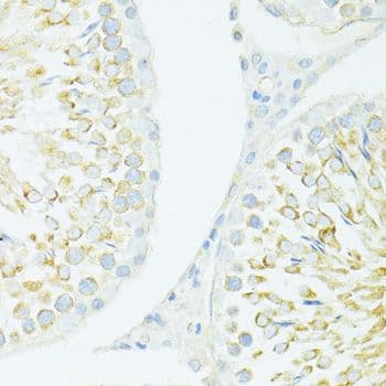 MYH10 Antibody