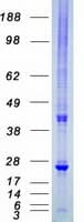 Human HSPB8 / H11 / HSP22 Protein (Recombinant Myc-DDK (Flag))
