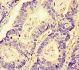 NRP2 / Neuropilin 2 Antibody