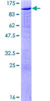Human SAFB2 Protein (Recombinant GST)