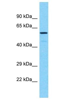 Polyclonal Rabbit anti-Human PRAMEF17 Antibody (aa127-176, WB)