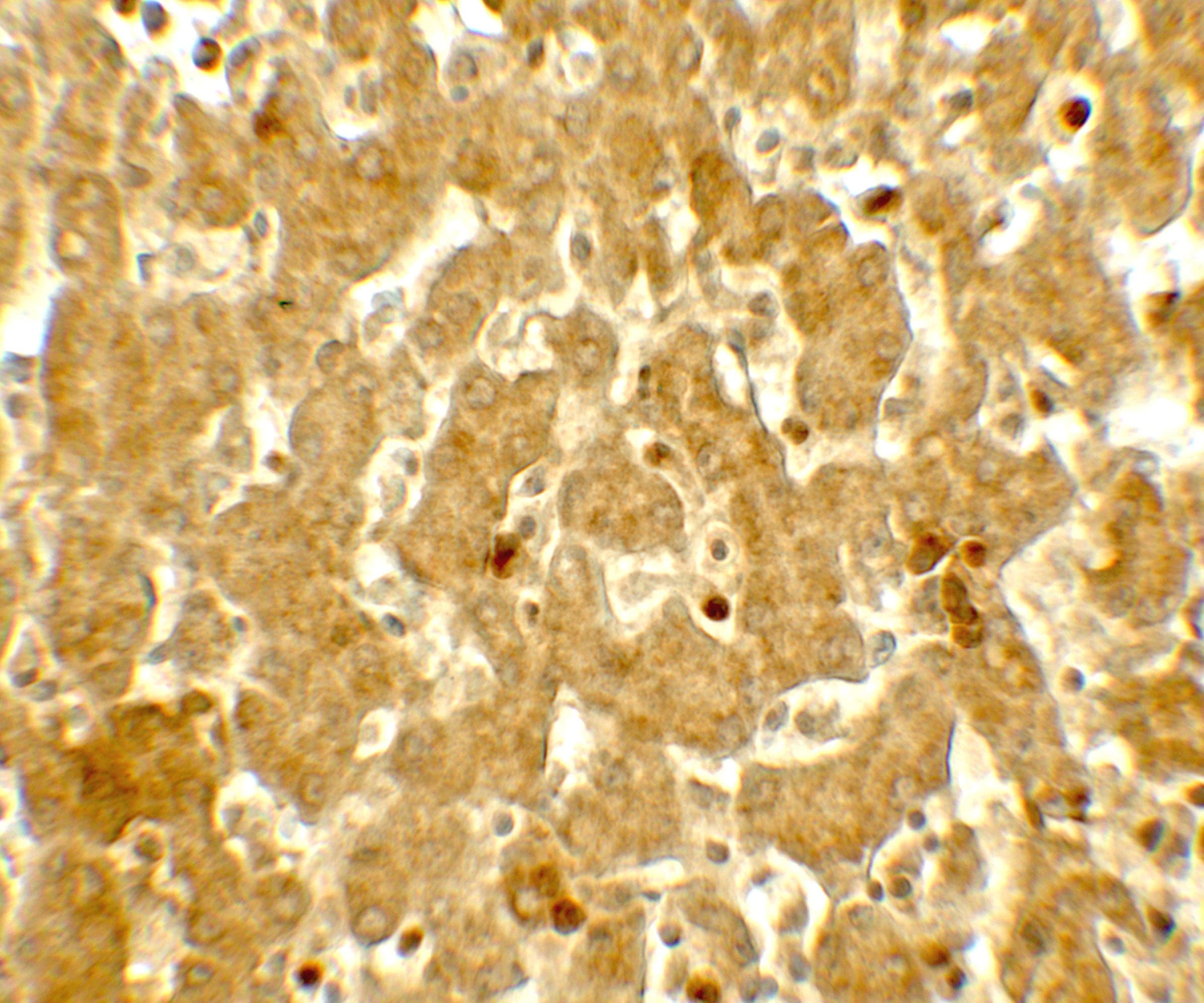 Polyclonal Rabbit anti-Human IFIT3 Antibody (IHC, WB)