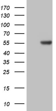 GC / Vitamin D-Binding Protein Antibody (clone OTI8C5)