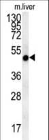Polyclonal Rabbit anti-Human NIPAL4 Antibody (aa9-37, IHC, WB)