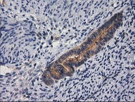GBA3 / CBG Antibody (clone OTI1F1)