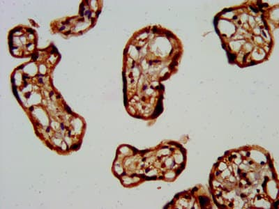 FKRP Antibody (aa28-140)
