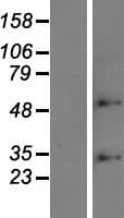 ZDHHC6 Protein (Over-Expression Lysate Myc-DDK (Flag))