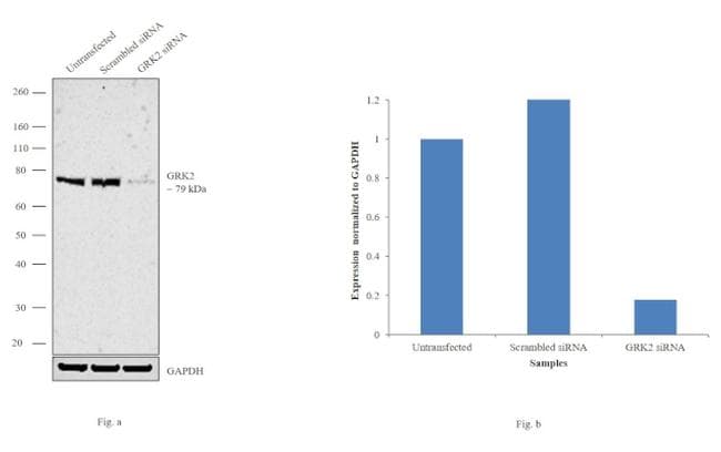 ADRBK1 / GRK2 Antibody (clone 3F8)