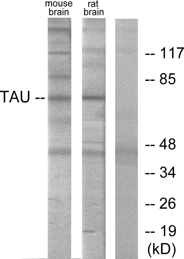 Polyclonal Rabbit anti-Human MAPT / Tau Antibody (aa641-690, WB)