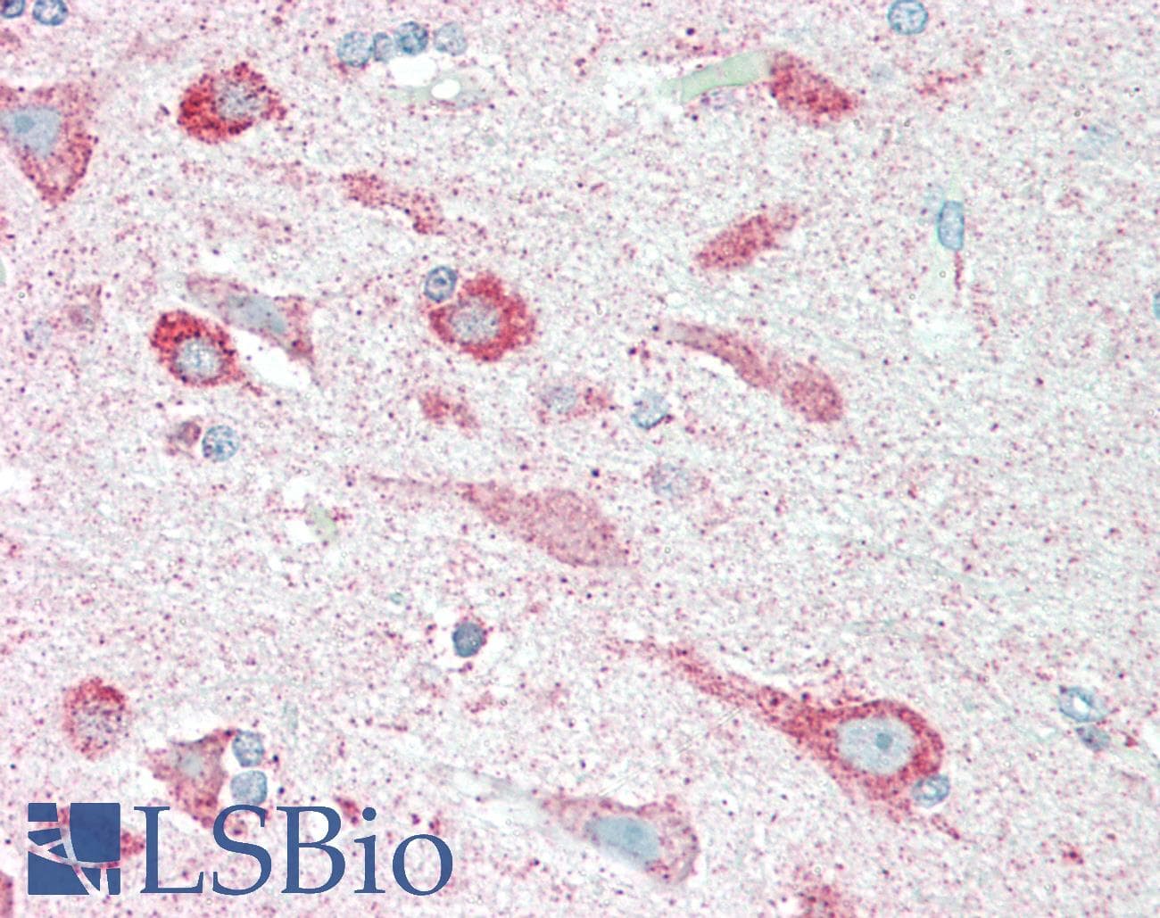 Polyclonal Rabbit anti-Human CLK1 / CLK Antibody (IHC, WB)