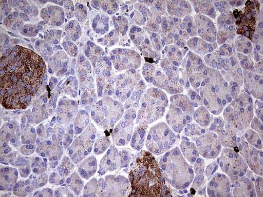 GBA / Glucosidase Beta Acid Antibody (aa40-315, clone UMAB171)