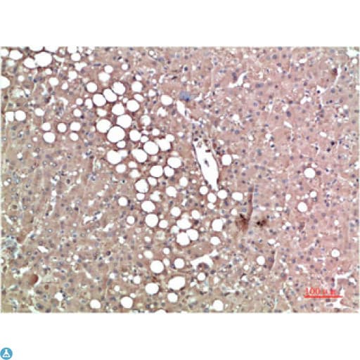 TTR / Transthyretin Antibody