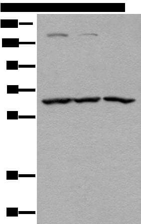 ATAD3A Antibody