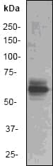 PAK1 Antibody (Ile206)