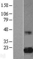 EIF5A Protein (Over-Expression Lysate Myc-DDK (Flag))