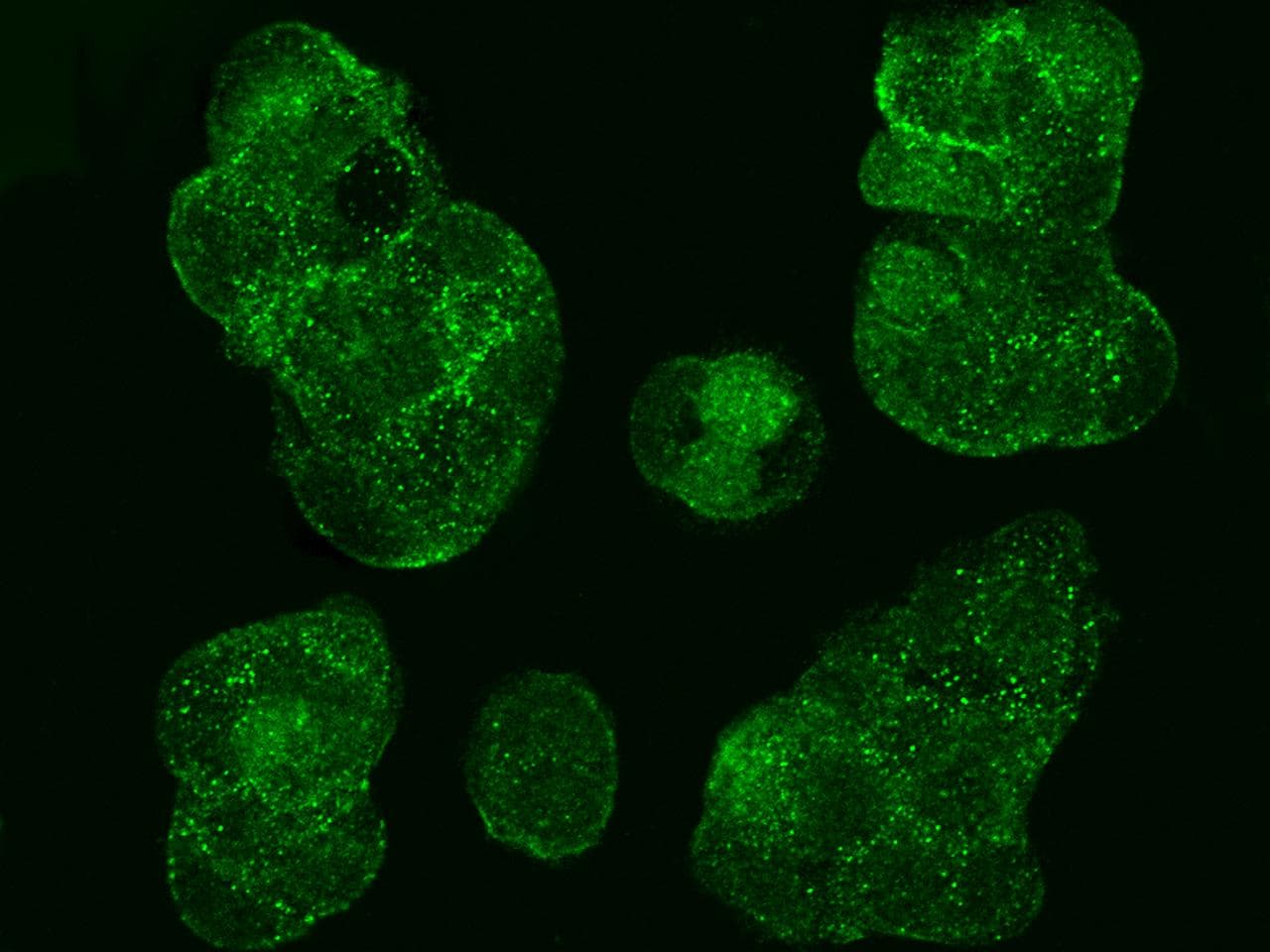 GDI1 Antibody (Preservative Free)