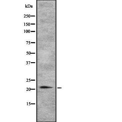 Polyclonal Rabbit anti-Human TGIF2LY Antibody (IHC, WB)