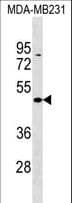 Polyclonal Rabbit anti-Human ZBTB25 Antibody (aa291-319, WB)